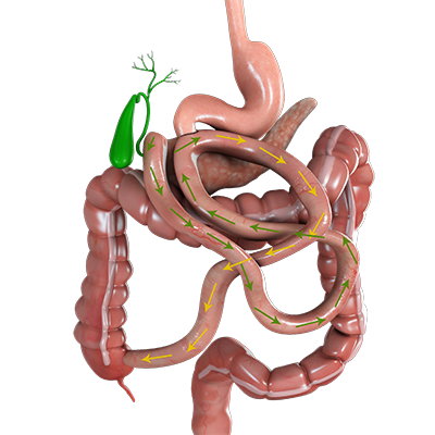 Single-anastomosis Duodeno-Ileal Bypass